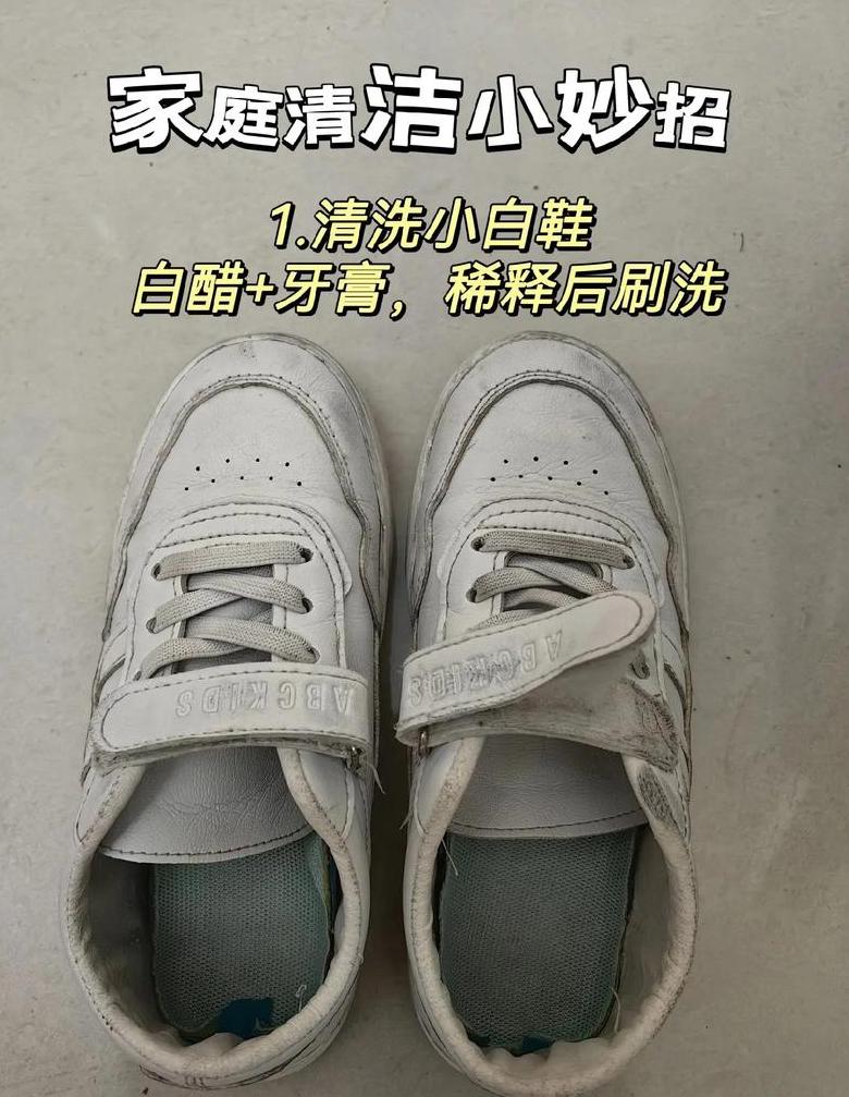 白鞋变黄？这些方法帮你轻松洗白