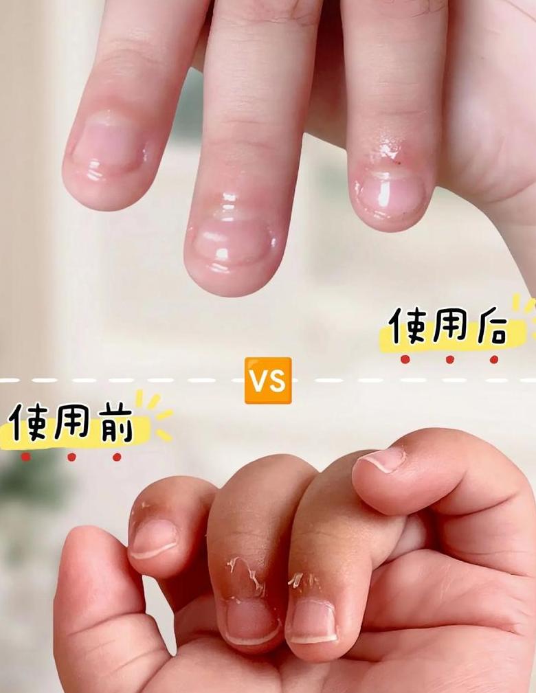 石材沥青清洁指南及衣物顽固污渍处理技巧