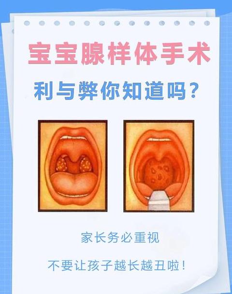 腺样体几岁开始萎缩